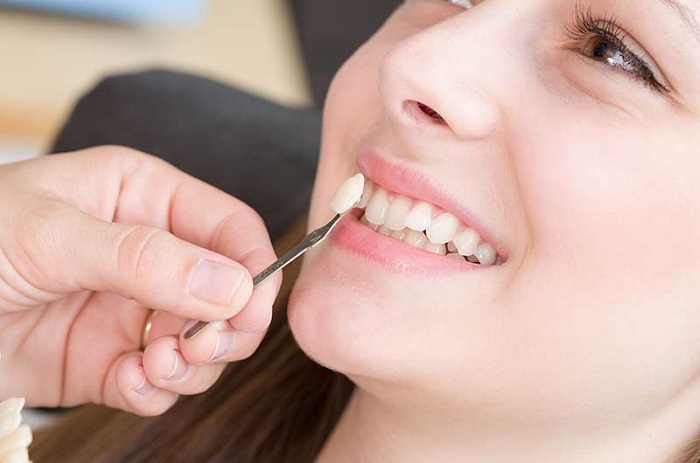 Bọc răng hàm bị sâu giá bao nhiêu? Có nên bọc răng sứ không?
