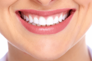 Tẩy trắng răng xong bị ê buốt? Nguyên nhân và cách điều trị?