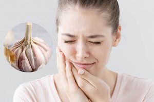 Chữa viêm chân răng bằng tỏi có được không? Cách chữa viêm chân răng bằng tỏi?