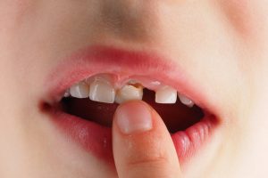 Răng sữa có tác dụng gì? Lưu ý khi chăm sóc răng sữa dành cho trẻ